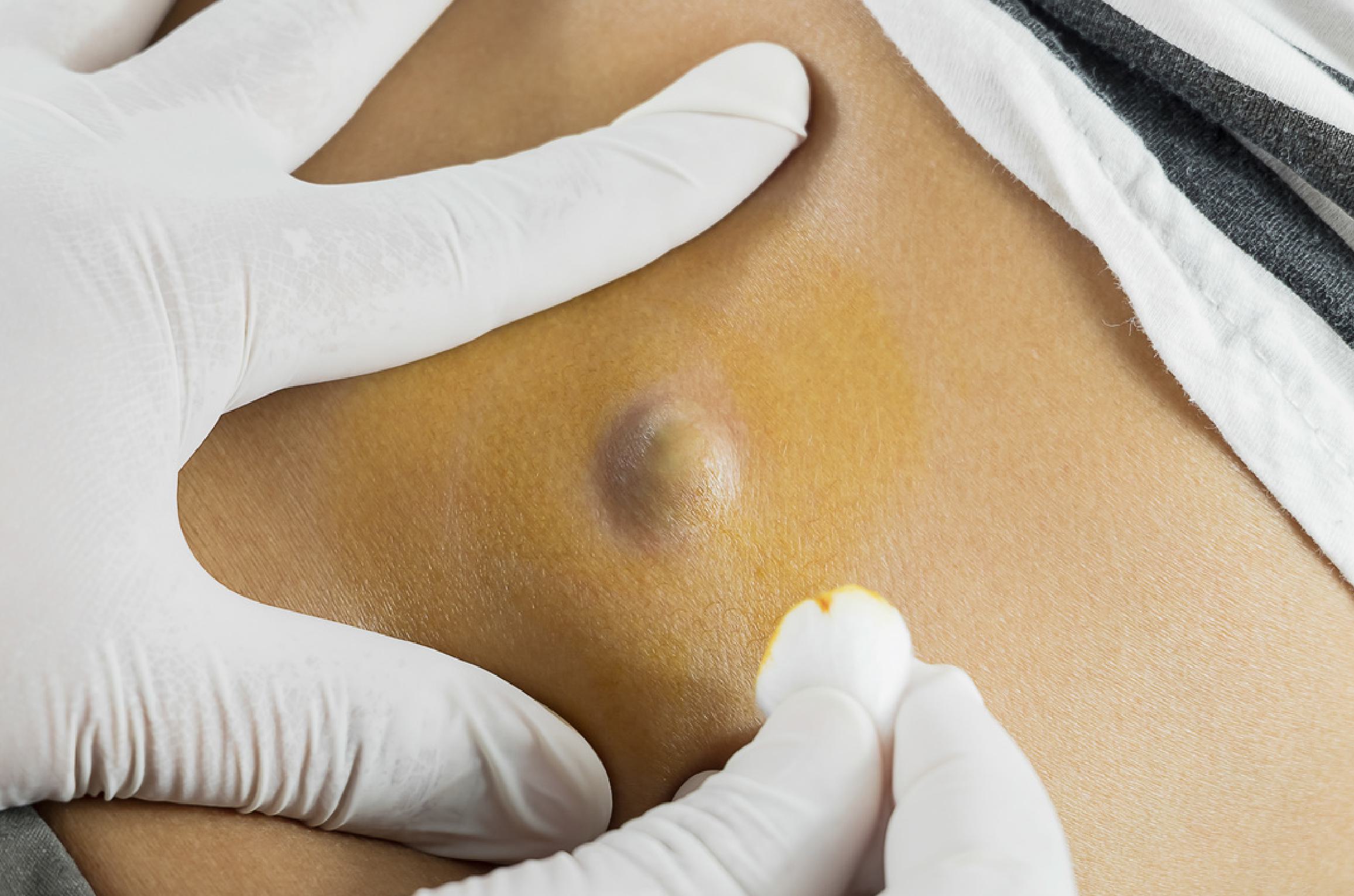 Dr. Shirisha Skin, Hair & Laser Clinic